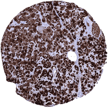 CELA3B antibody