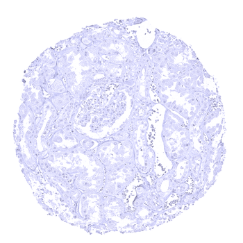 CELA3B antibody