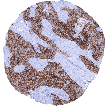 TACSTD2 / Trop-2 antibody