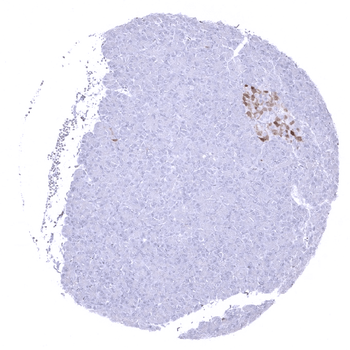 p16 antibody