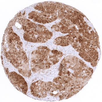 p16 antibody