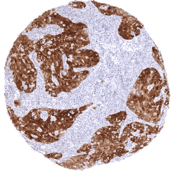 p16 antibody