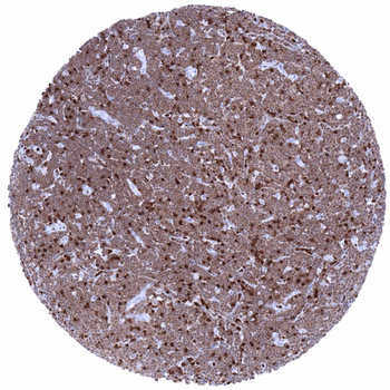 ZAP-70 antibody