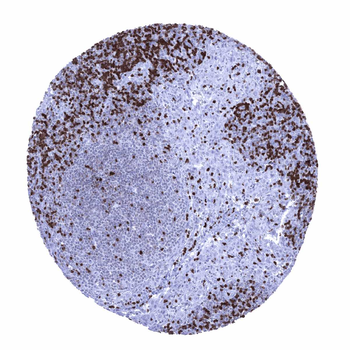 ZAP-70 antibody