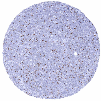 ZAP-70 antibody