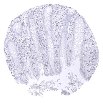 Transcription factor E3 / TFE3 antibody (MSVA-403R)