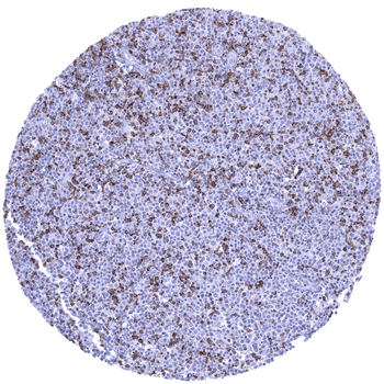 CTLA-4 antibody