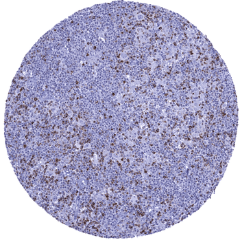 CTLA-4 antibody