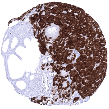 PGP9.5 / UCHL1 antibody (MSVA-905R)