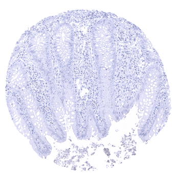 PAPP-A antibody
