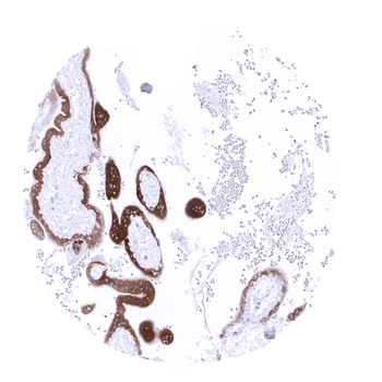 PAPP-A antibody