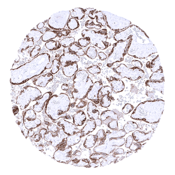 PAPP-A antibody