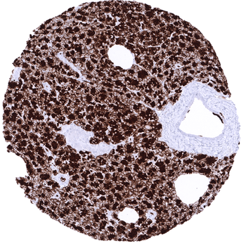 GP2 antibody