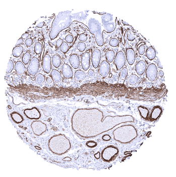 Collagen IV antibody (MSVA-704R)