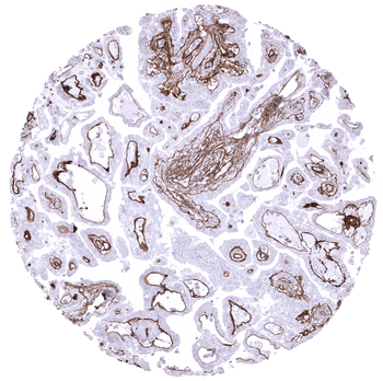 Collagen IV antibody (MSVA-704R)