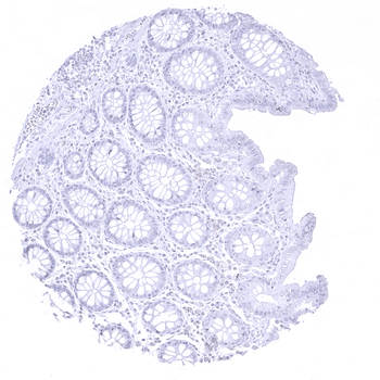 CPA1 antibody