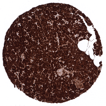 CPA1 antibody