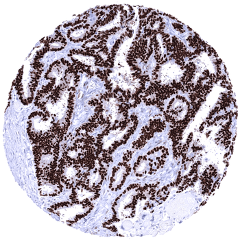 Progesterone Receptor antibody