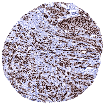 Progesterone Receptor antibody