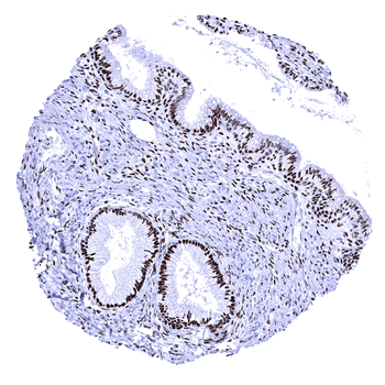Progesterone Receptor antibody