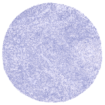 PAX8 antibody