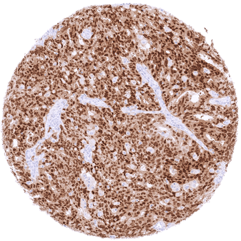 PAX8 antibody
