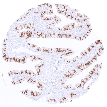 PAX8 antibody