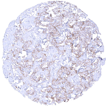 HER2 / CD340 antibody