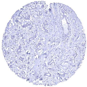 HER2 / CD340 antibody