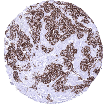 HER2 / CD340 antibody