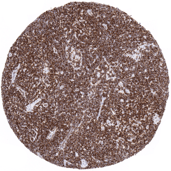 CD5 antibody