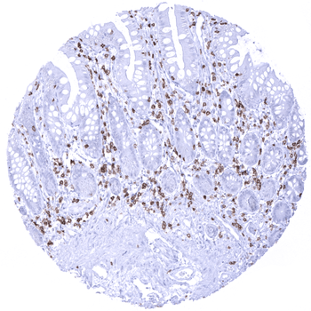 CD5 antibody