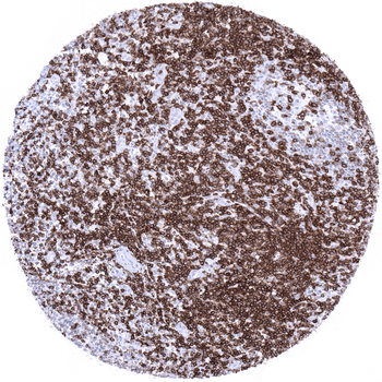 CD5 antibody
