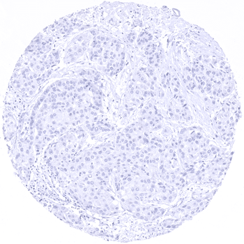 Arginase-1 antibody