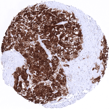 Arginase-1 antibody
