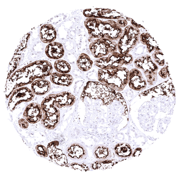 ACE2 antibody (MSVA-919R)