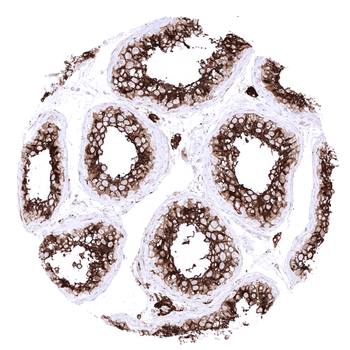 ACE2 antibody (MSVA-919R)