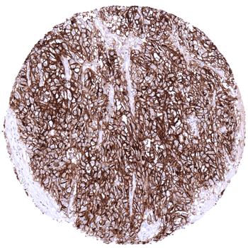 ACE2 antibody (MSVA-919R)