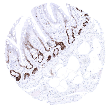 MCM3 antibody
