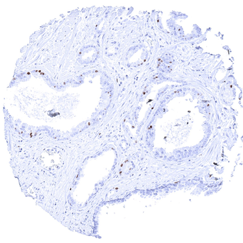 MCM3 antibody