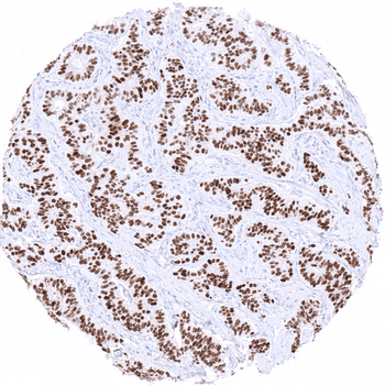 INSM1 antibody (MSVA-456R)