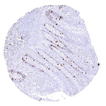 Topoisomerase 2-alpha / TOPO2A antibody