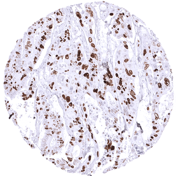 Topoisomerase 2-alpha / TOPO2A antibody