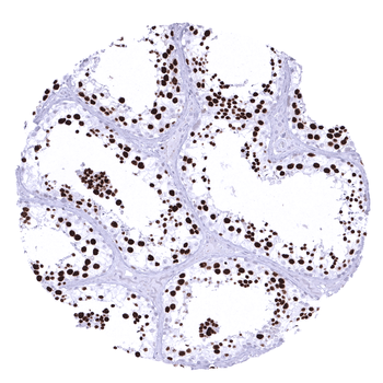 Topoisomerase 2-alpha / TOPO2A antibody