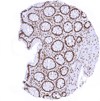 Histone H3 / H3-3A antibody (MSVA-903M)