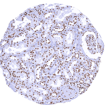 Histone H3 / H3-3A antibody (MSVA-903M)
