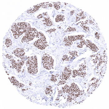 GATA3 antibody