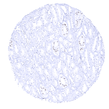 GATA3 antibody