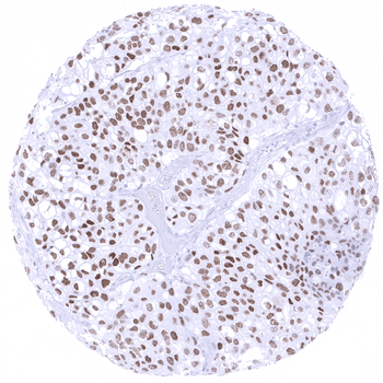 GATA3 antibody