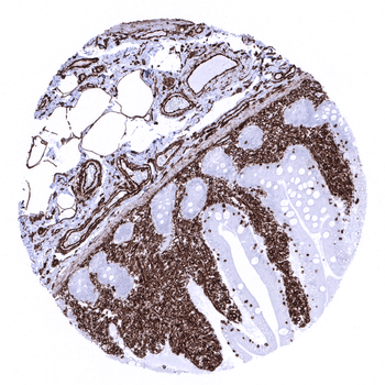 Vimentin antibody